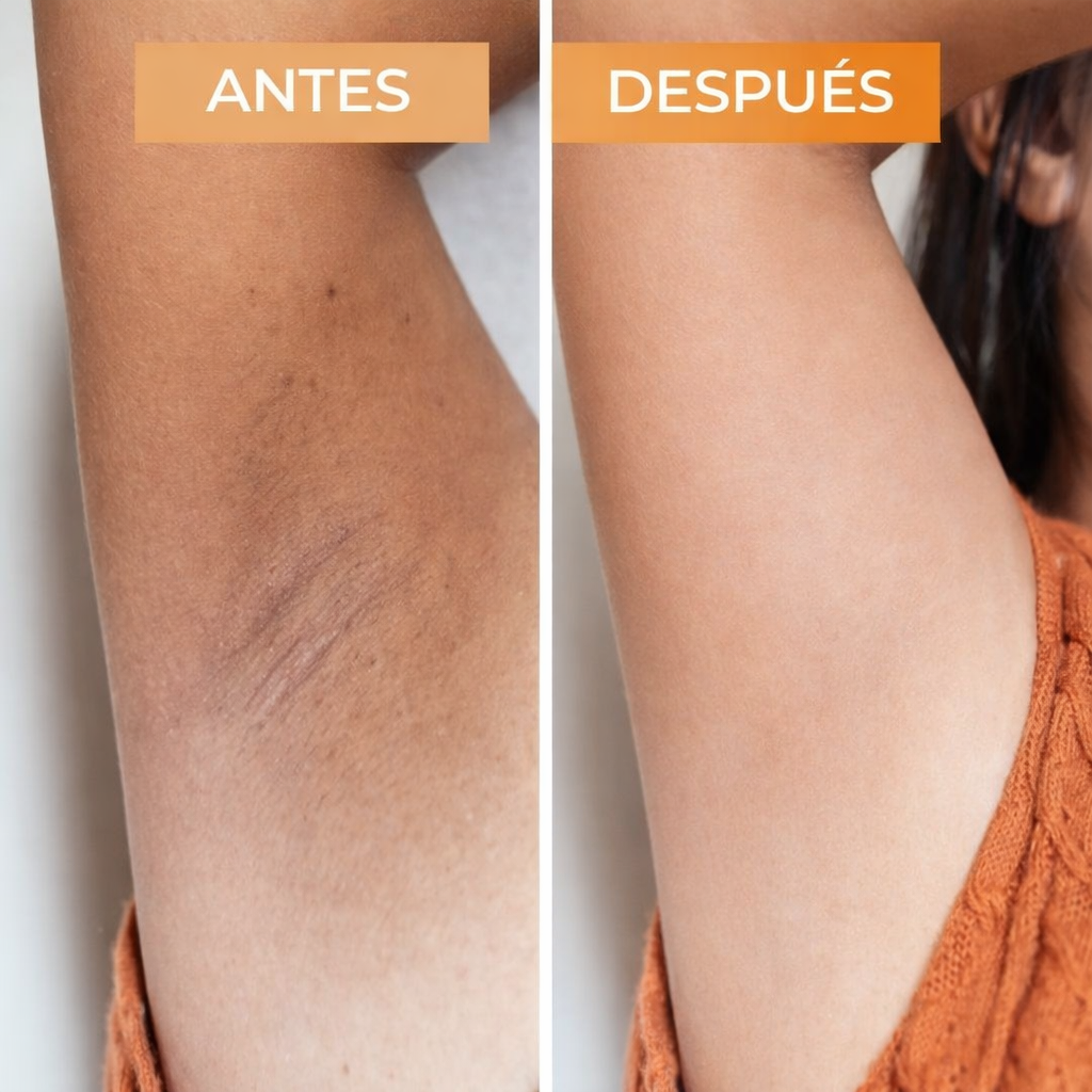Gel Exfoliante Enzimatico de Naranja