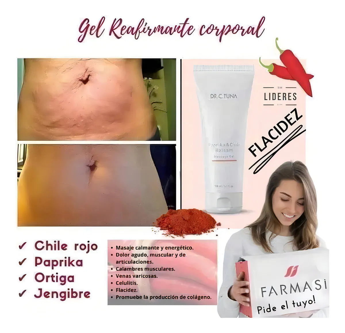 GEL REDUCTOR  Flacidez   - Inflamación - Estrías  D.R.C.  TUNA